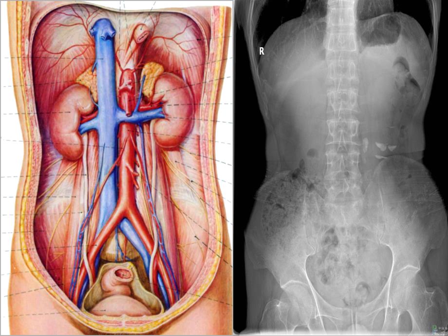 影像学腹部ppt课件_第3页