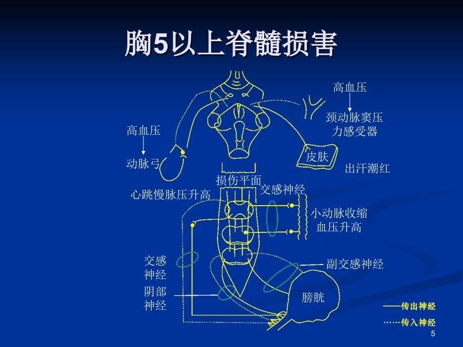 截瘫性神经原性膀胱的 表现和处理PPT课件_第5页