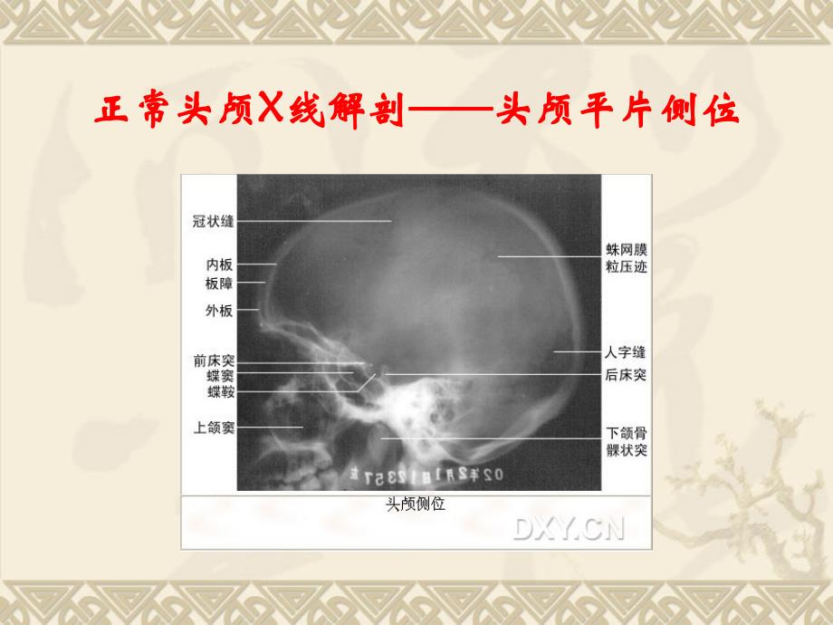 《医学X线正常解剖》PPT课件.ppt_第2页