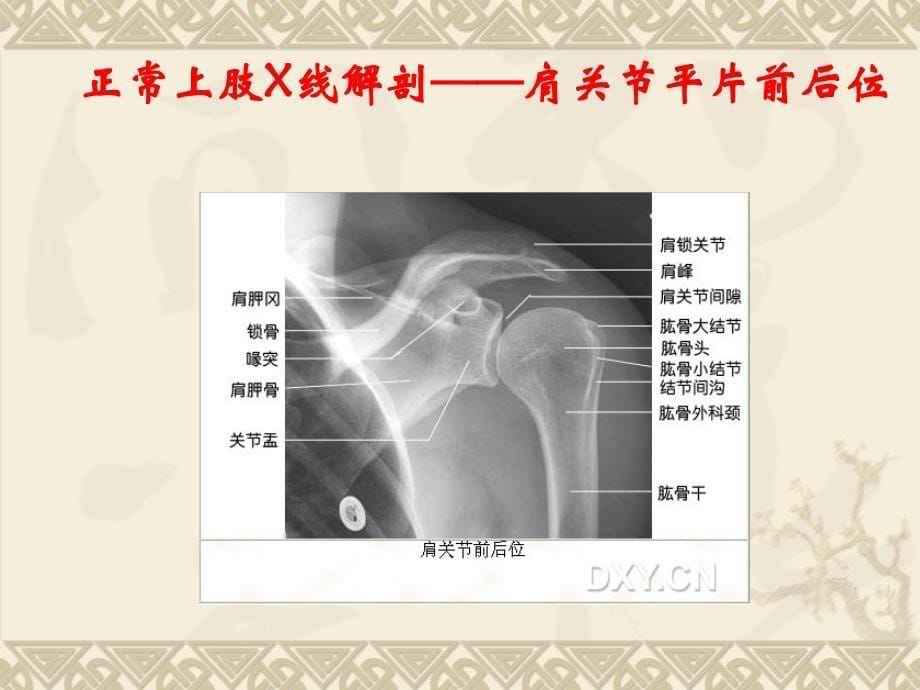 《医学X线正常解剖》PPT课件.ppt_第5页