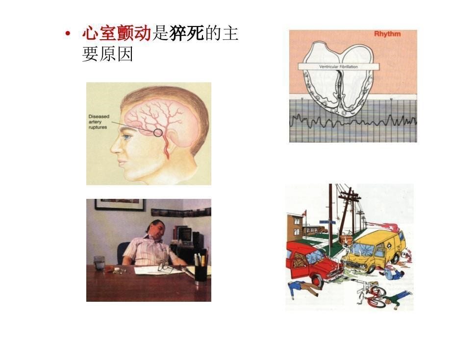 急救初级救生术_第5页