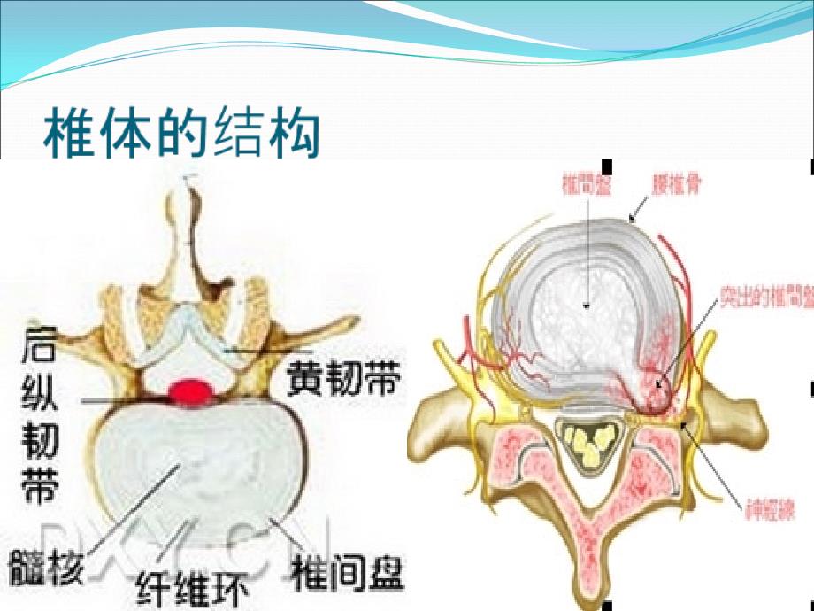 腰椎间盘突出症病人的护理_第4页