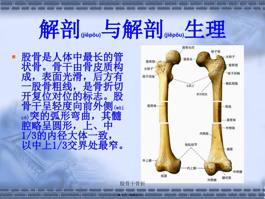 股骨干骨折课件_第3页