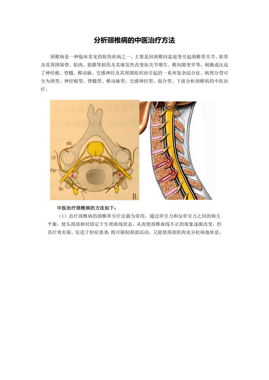 分析颈椎病的中医治疗方法_第1页