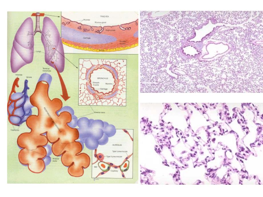 呼吸系统教学资料呼吸系统疾病_第3页