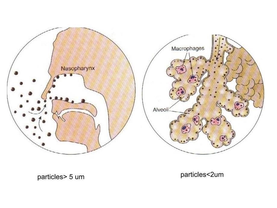 呼吸系统教学资料呼吸系统疾病_第5页