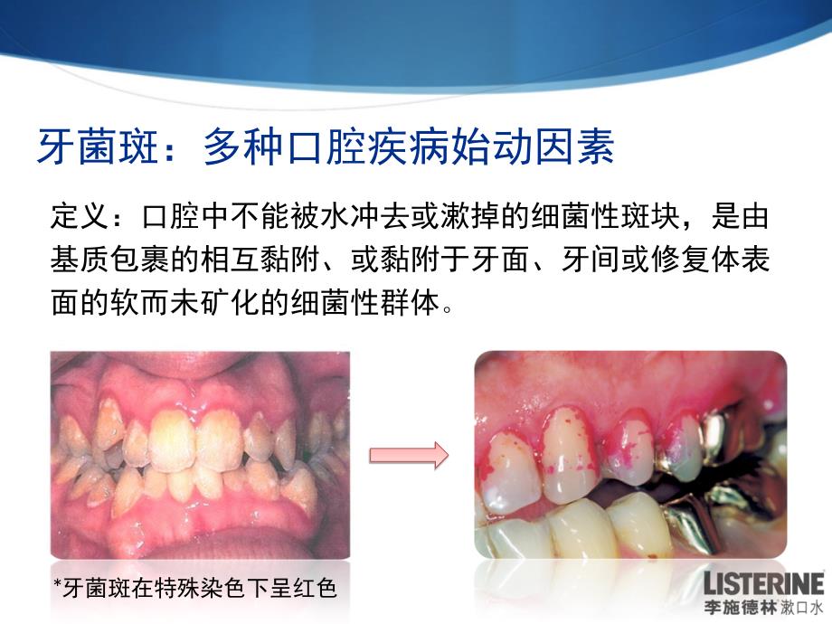 孕妇口腔保健_第3页