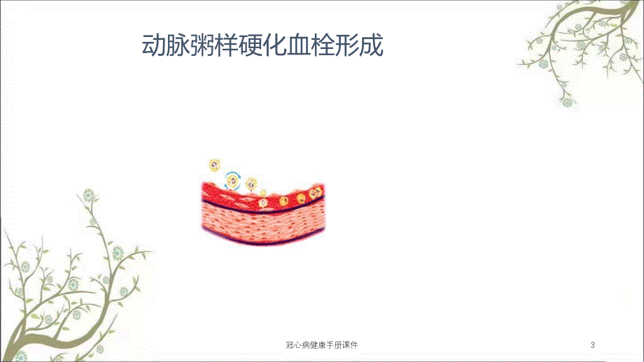 冠心病健康手册课件_第3页