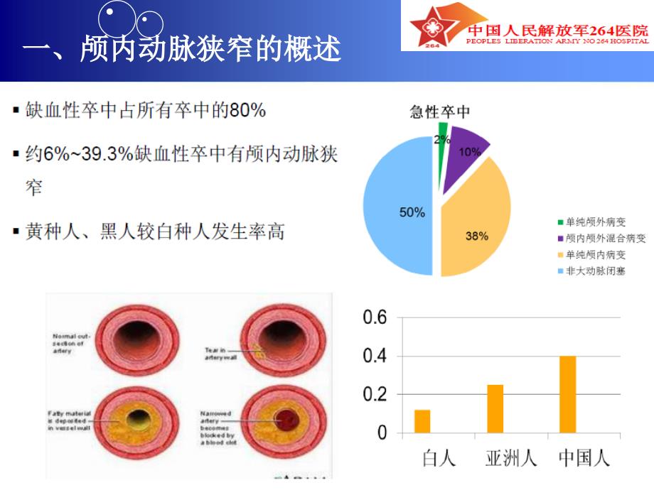 颅内支架成形术ppt课件_第3页