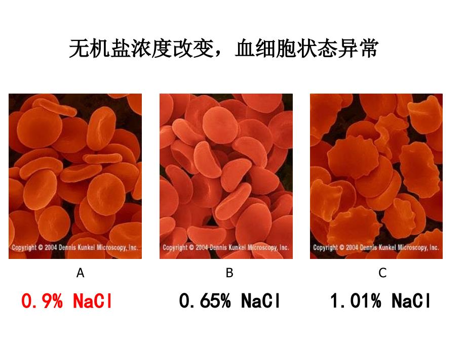 人体内废物的排出复习课件_2_第3页