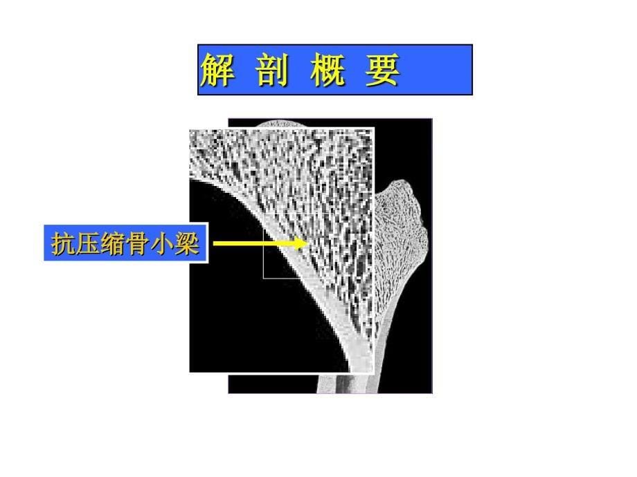 股骨颈骨折PPT012_第5页