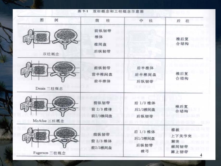 椎弓根钉置入技术PPT课件_第4页