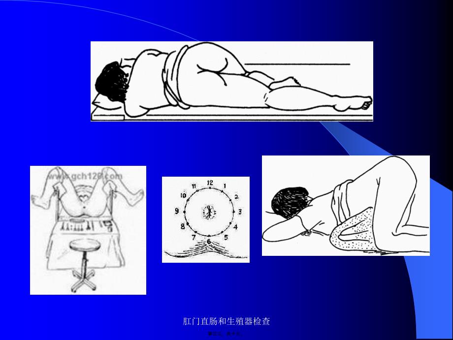 肛门直肠和生殖器检查课件_第3页