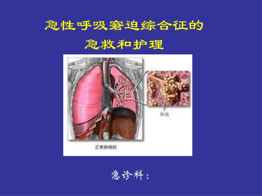 急性呼吸窘迫综合征的急救和护理课件_第1页