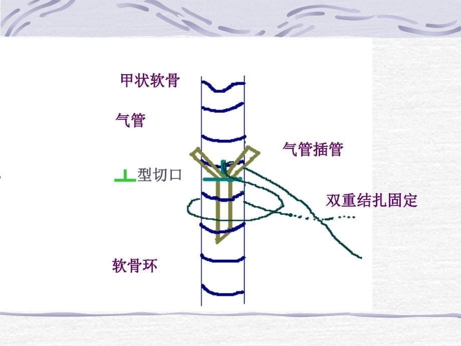 影响家兔血压的因素.ppt_第5页