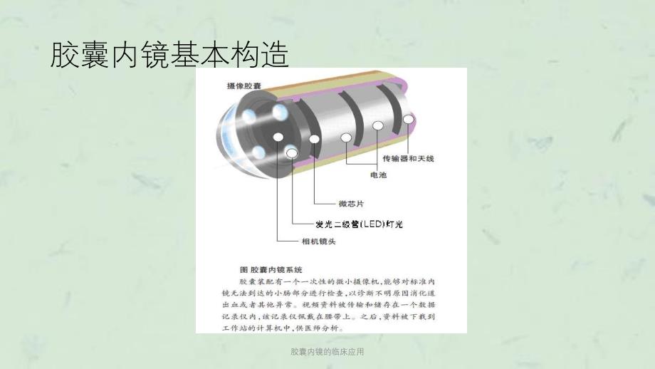 胶囊内镜的临床应用课件_第4页