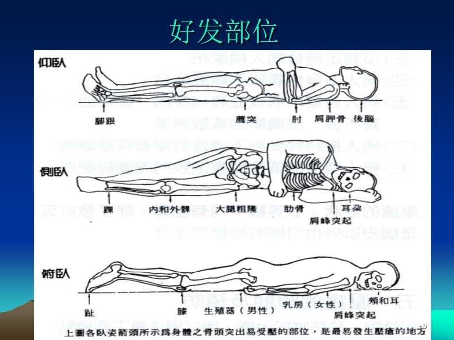 神经外科基础护理的几个方面ppt课件_第5页