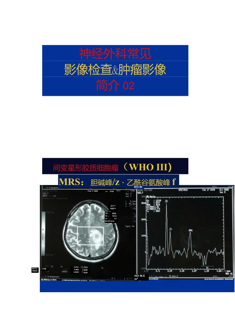 神经外科常见影像学与肿瘤简介02._第1页