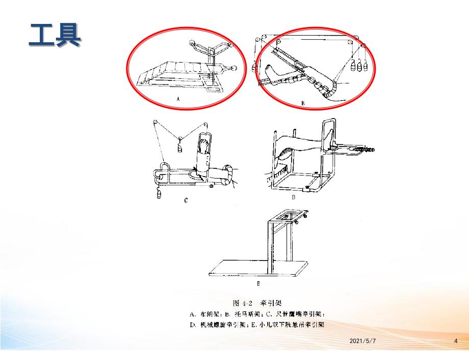 骨科牵引和石膏固定术_第4页