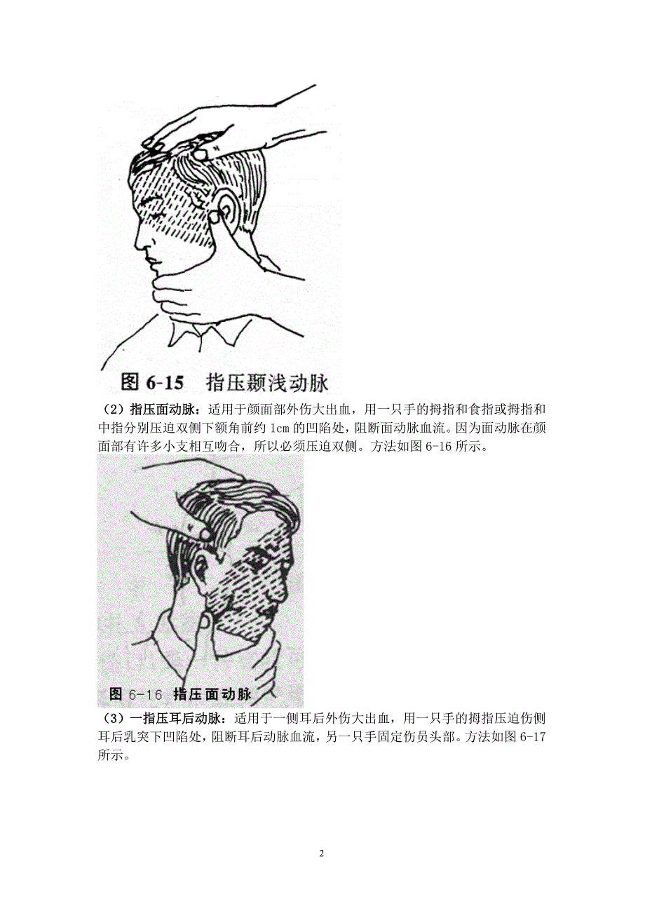 止血法资料辅助图解.doc_第2页