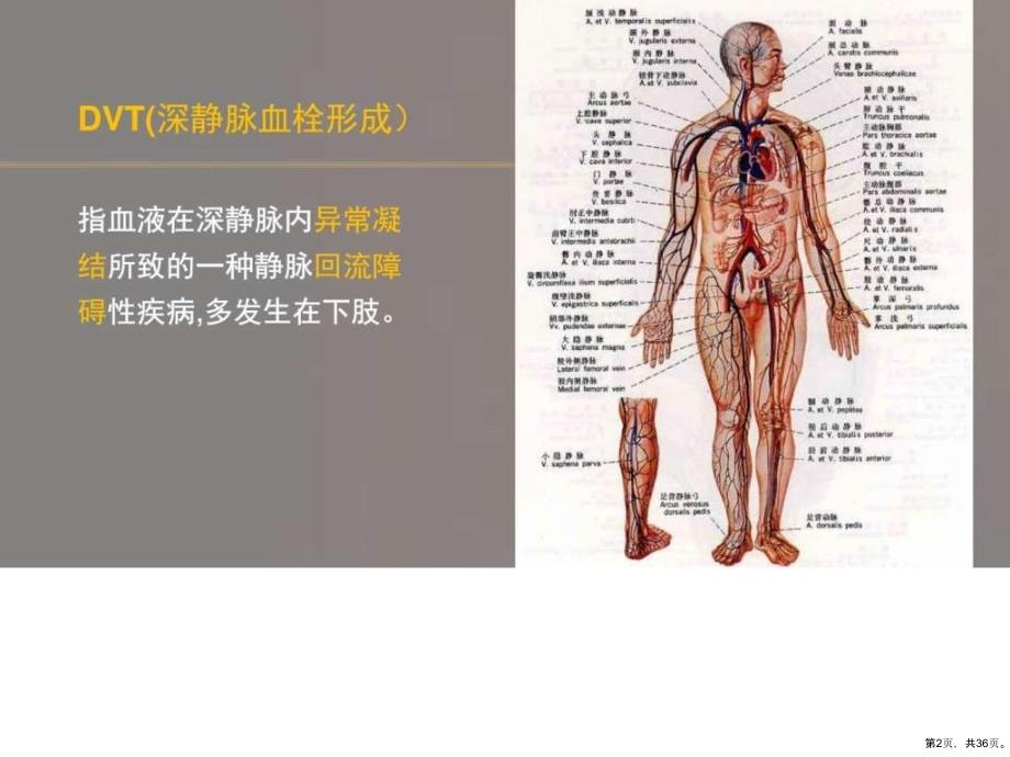 dvt的预防及护理_预防医学_医药卫生_专业课件_第2页