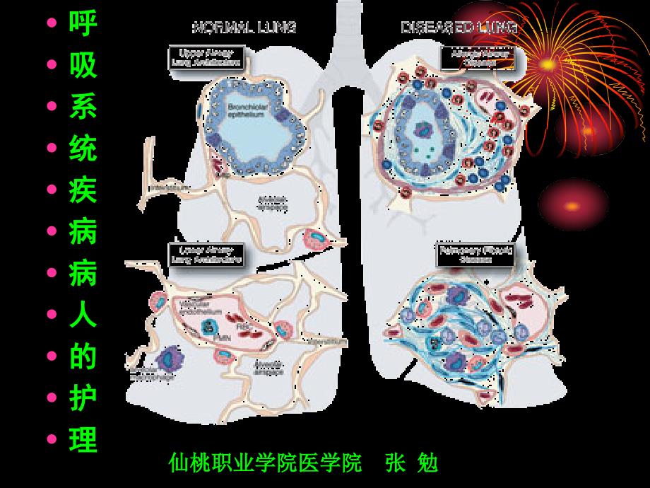 呼吸系统一般护理和常见症状_第1页