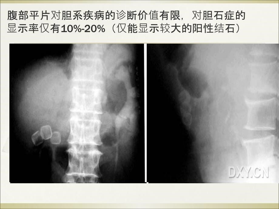 《胆系疾病》PPT课件_第5页