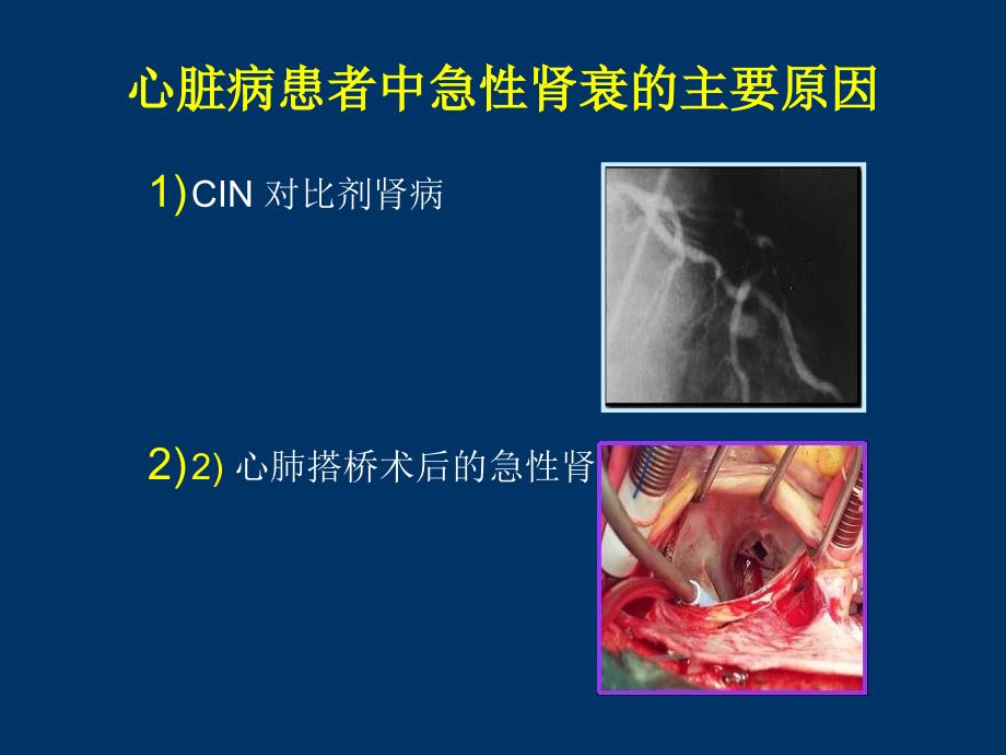 CIN中国专家共识_第2页