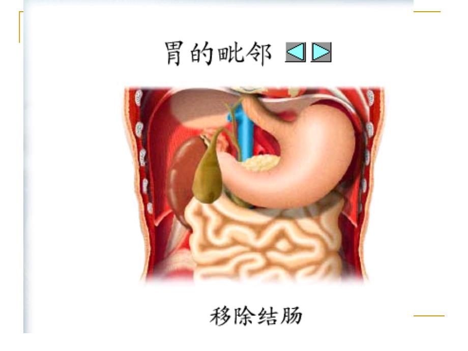 胃十二指肠疾病病人的护理ppt_第4页