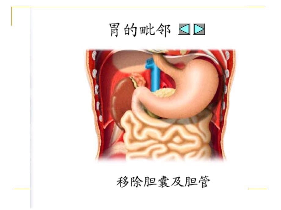 胃十二指肠疾病病人的护理ppt_第5页