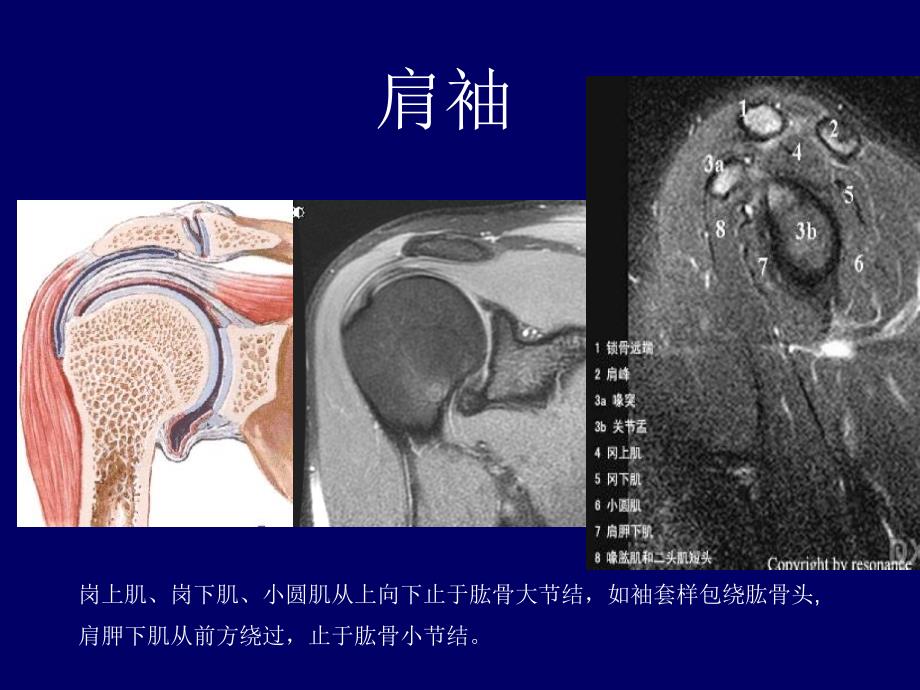 肩关节应用解剖及腱鞘肌腱病的磁共振影像诊断_第3页