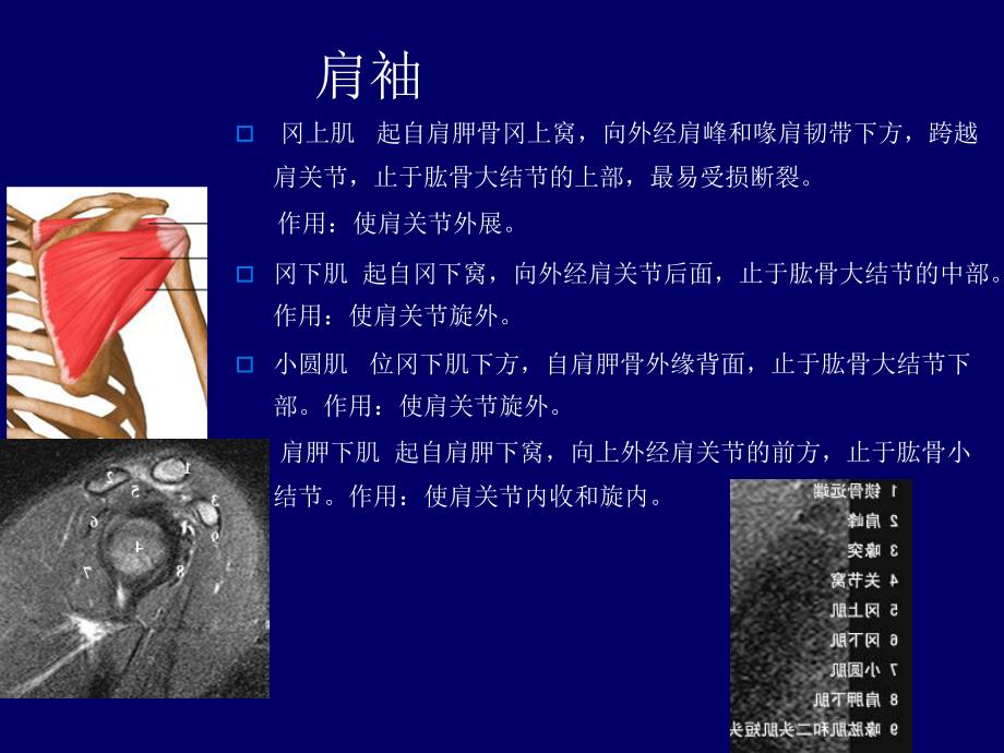 肩关节应用解剖及腱鞘肌腱病的磁共振影像诊断_第4页