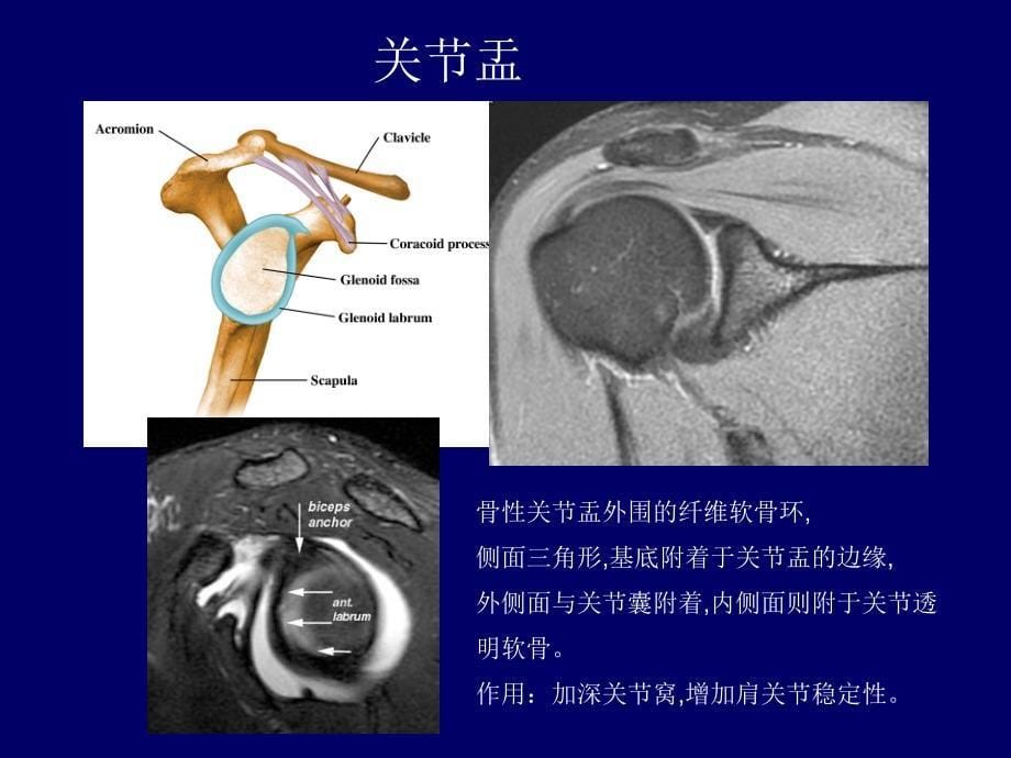 肩关节应用解剖及腱鞘肌腱病的磁共振影像诊断_第5页