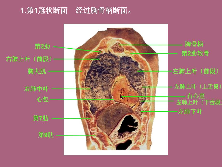 胸部冠矢状断面解剖ppt课件_第4页