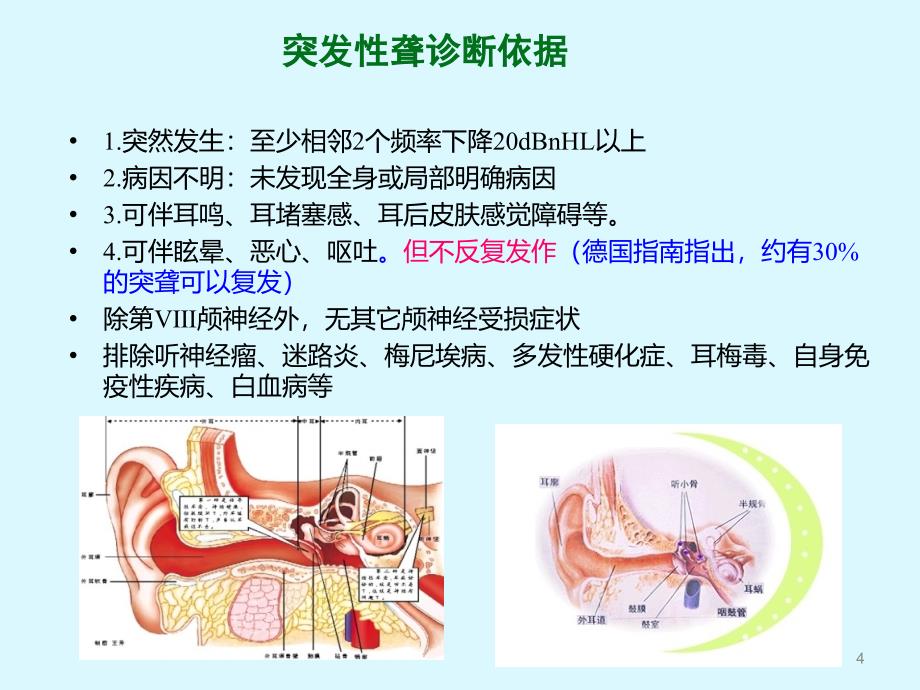 突发性耳聋的诊疗进展及指南解读ppt课件_第4页