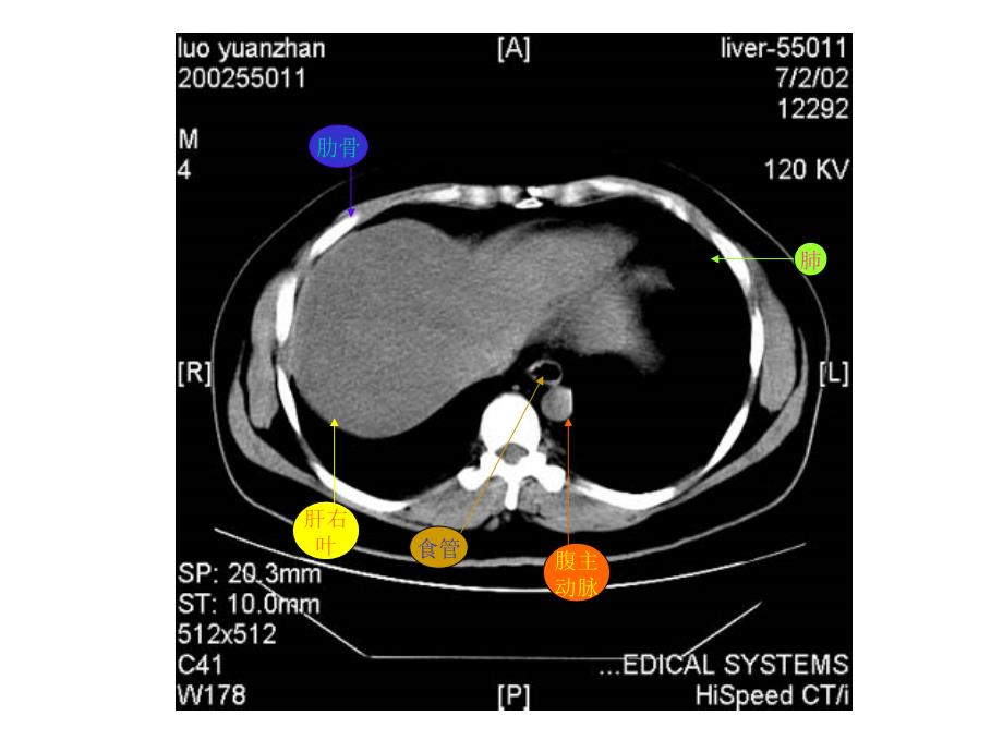 腹部CT断层解剖结构_第2页