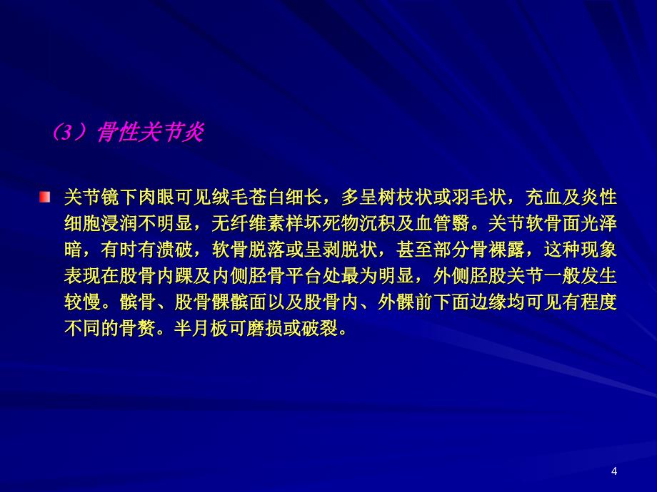 关节检查及关节痛鉴别诊断_第4页