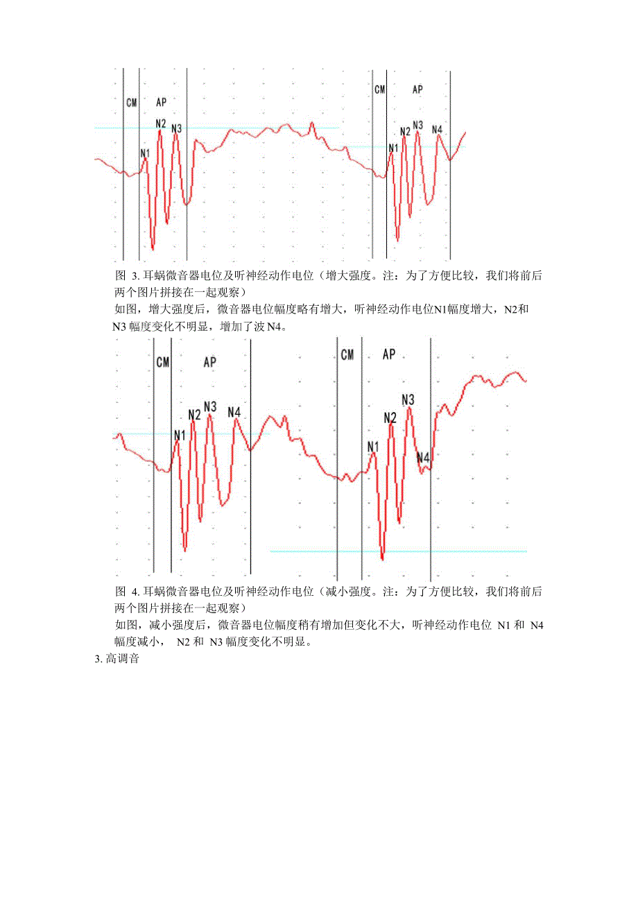 耳蜗微电位_第3页
