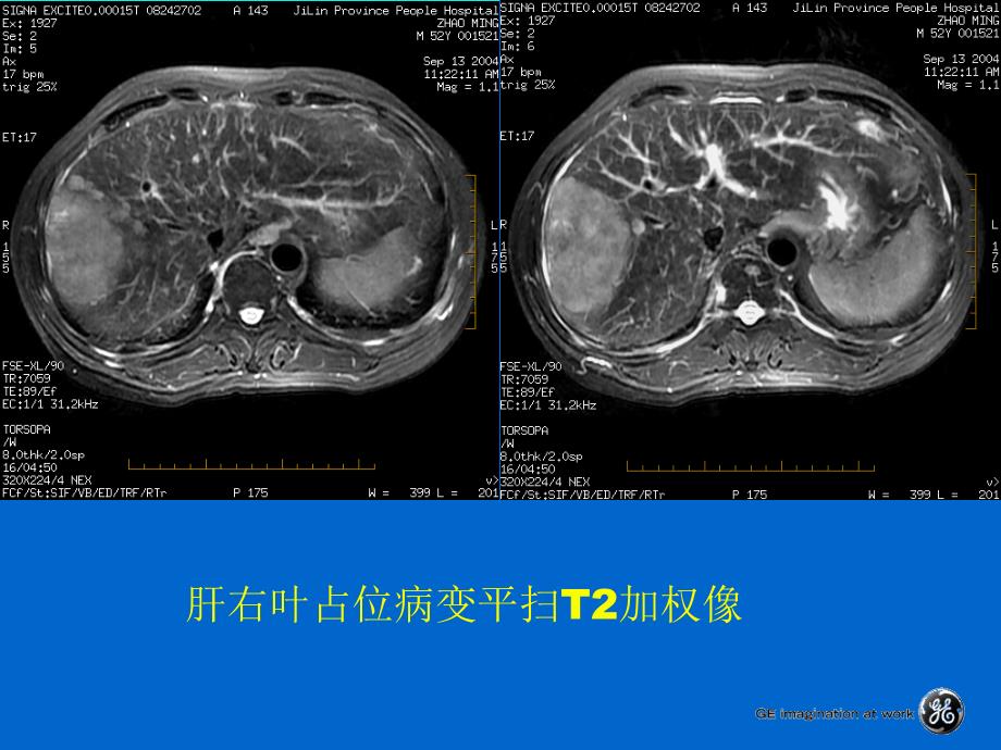 腹部扫描脉冲序列_第3页