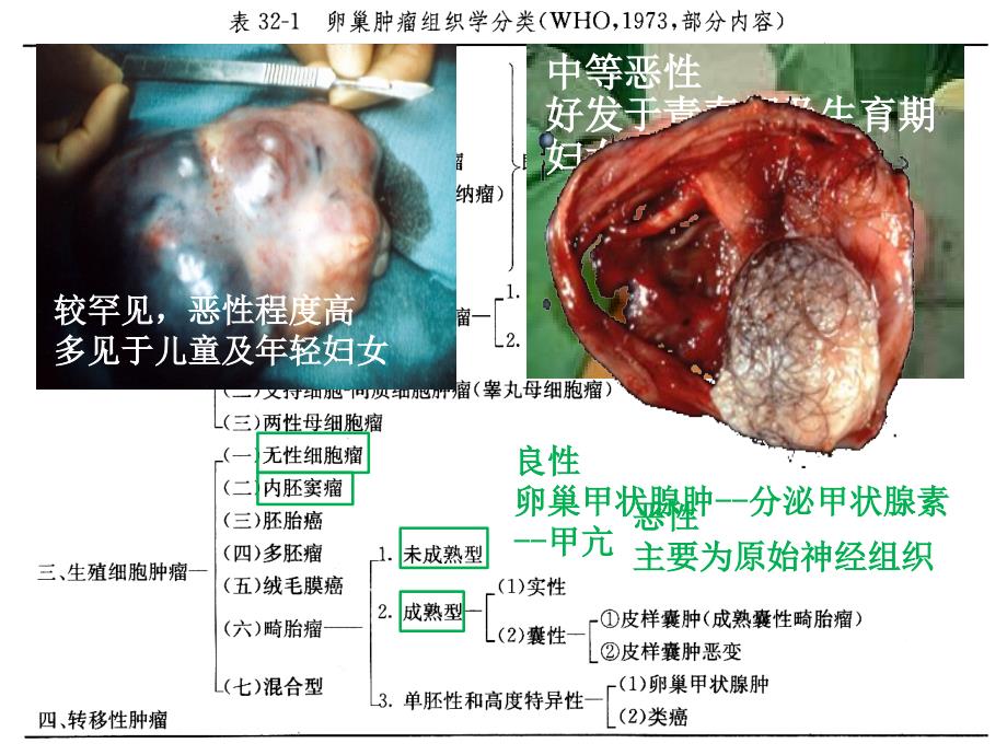 自己做的卵巢癌NCCN解读(2)学习资料_第2页