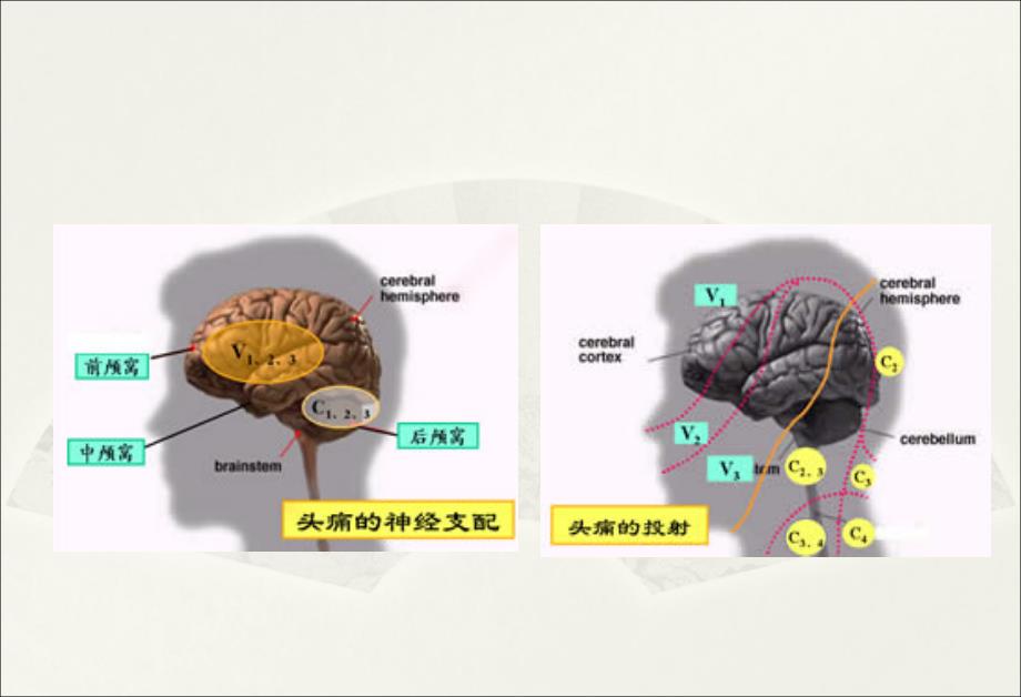 指南偏头痛PPT课件复习课程_第5页