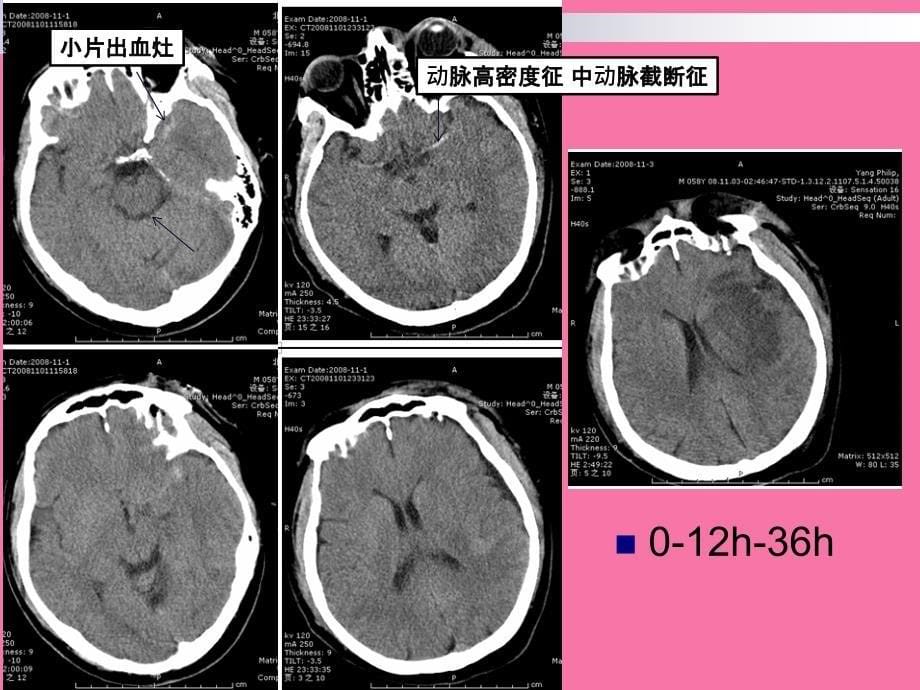 神经系统读ppt课件_第5页