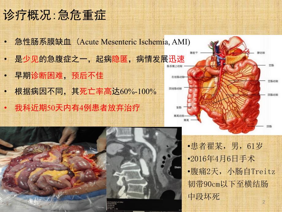 （推荐医学）急性肠系膜缺血性疾病的诊治_第2页