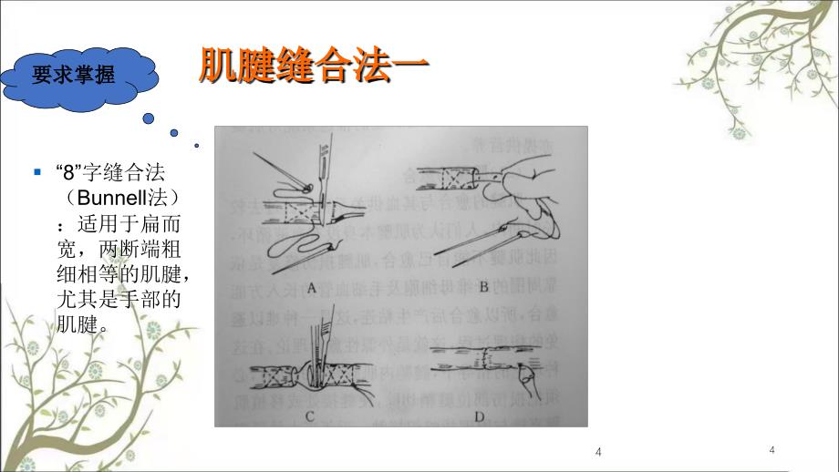 肌腱缝合术免金币课件_第4页