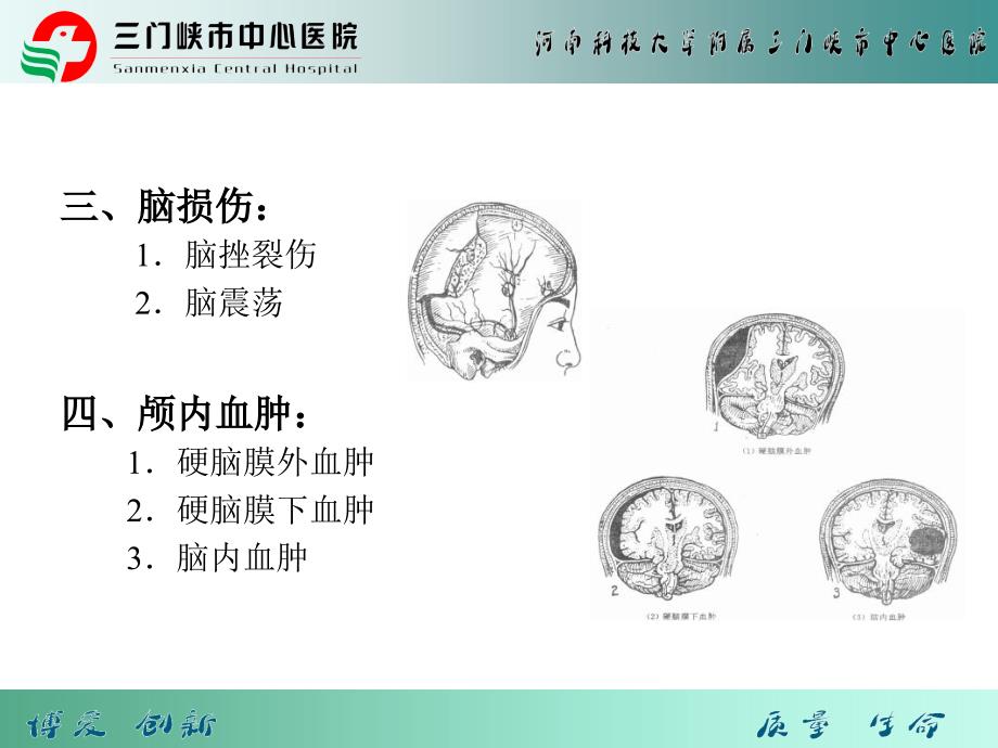 颅脑损伤患者健康宣教_第3页