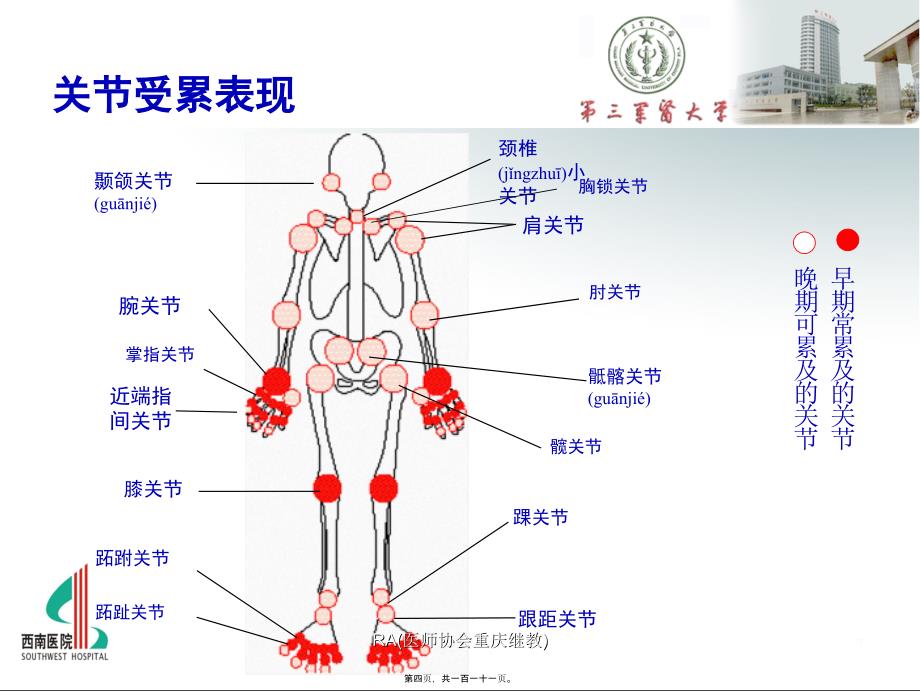 RA医师协会重庆继教课件_第4页