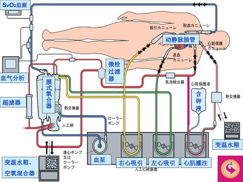 医学课件体外循环设备与实施_第4页