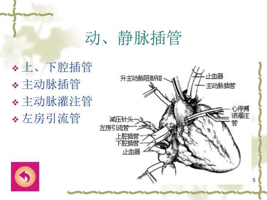 医学课件体外循环设备与实施_第5页