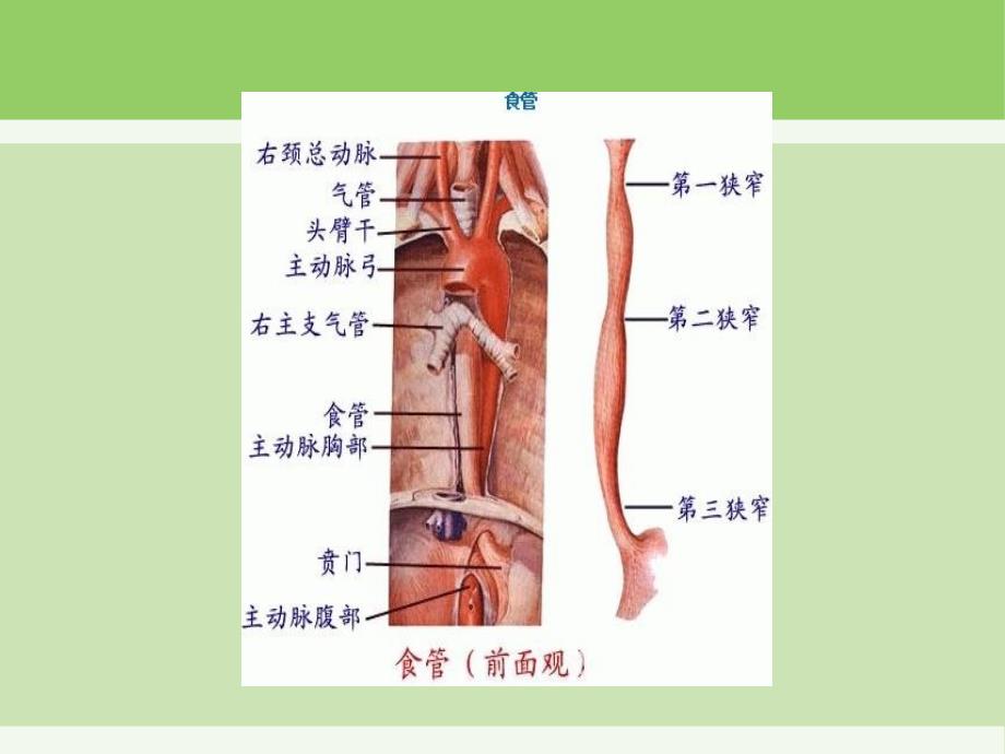 食道癌护理查房_第3页