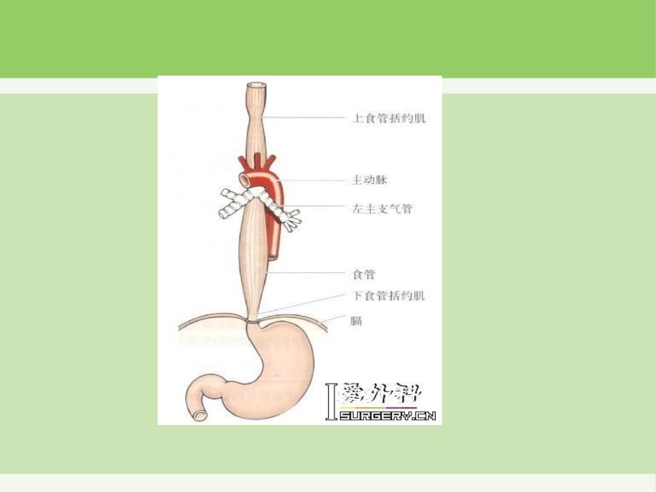 食道癌护理查房_第4页